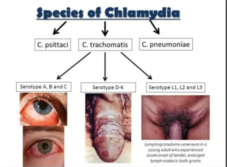 Nhóm Chlamydia
