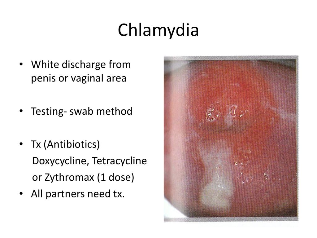 Chlamydia trachomatis infections